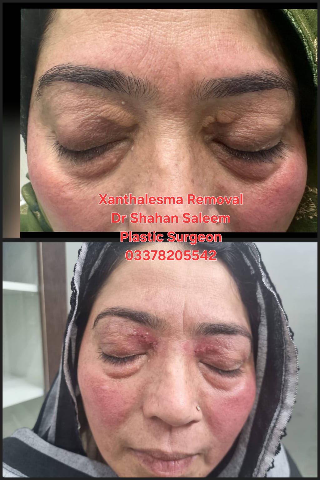 Before & After 15